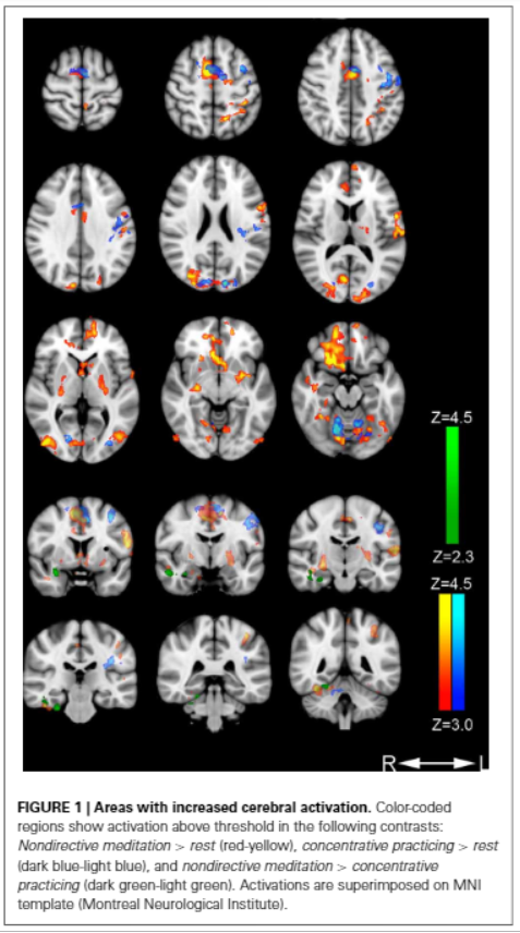 brain imaging of subjects using different types of meditation, directive, non directive, permissive